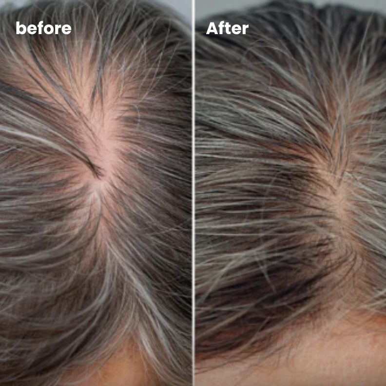 Velura Hair Ampoule Serum™**
